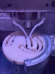 تقنية CAD/CAM الرقمية في عيادة الدكتور فراس يبرودي – دبي