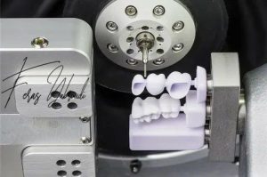 CAD/CAM Dental Technology at Dr. Firas Yabroudi’s clinic in Dubai
