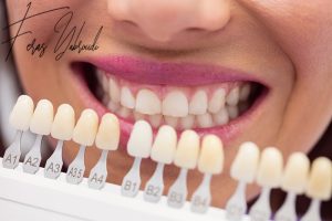 Cosmetic dental treatments
